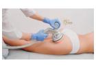 Simple and Effective Cellulite Treatment San Diego Solutions