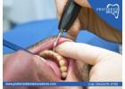 Say Goodbye to Decay with Expert Cavity Protection Service