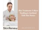 Micro Needling in Auckland – Advanced Care for Skin Renewal