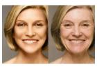 Restore Youthful Skin in Just Days!