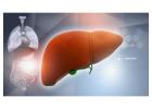 Liver Replacement Surgery | Maddadgar Foundation