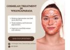 Cosmelan Treatment Whangaparaoa | Safe & Effective Results