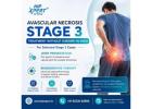 Avascular Necrosis Stage 3 Treatment without Surgery in India – HipXpert