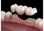 Trusted Dentist in Abbotsford | Your Local Dentist Near Me
