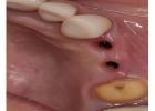 Revive your natural and flawless smiles with holistic Dental care in Tijuana