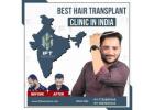 hair transplant for men Rajasthan
