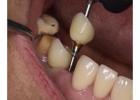 Holistic Dentist in Mexico – Natural, Biocompatible Care for Your Health and Smile